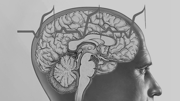 cerveau activite electrique cerveau activite electrique